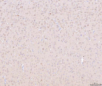 Anti-NDUFB8 Antibody