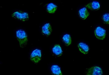 Anti-ND6/MT-ND6 Antibody