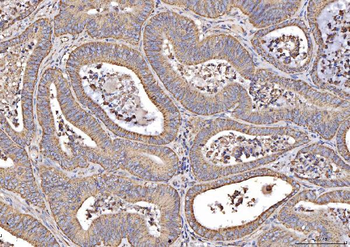 Anti-MT-CO2 Antibody