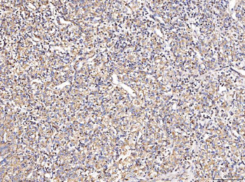 Anti-MT-CO2 Antibody