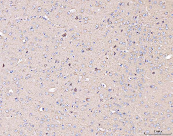 Anti-MT-CO2 Antibody