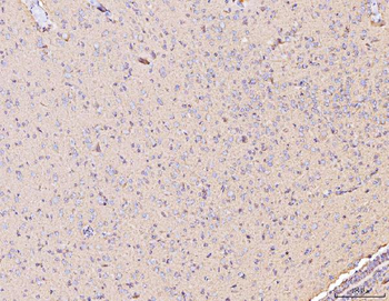 Anti-MT-CO2 Antibody