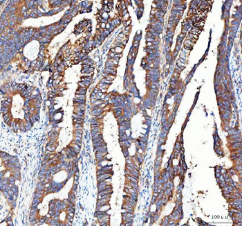 Anti-Integrin alpha 3/ITGA3 Antibody