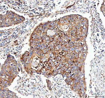 Anti-Integrin alpha 3/ITGA3 Antibody