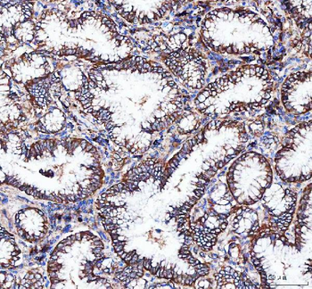 Anti-Integrin alpha 3/ITGA3 Antibody