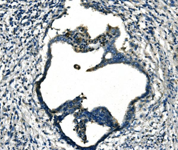Anti-FGF4 Antibody