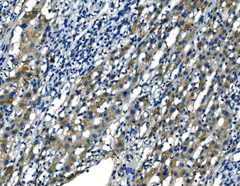 Anti-FGF4 Antibody
