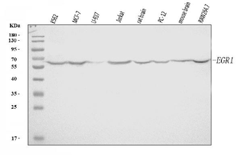 Anti-EGR1 Antibody