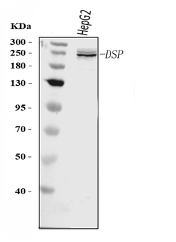 Anti-Desmoplakin/DSP Antibody