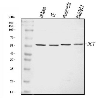 Anti-TRP2/DCT Antibody
