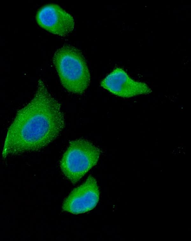 Anti-DAB2 Antibody