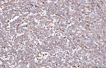 Anti-DAB2 Antibody