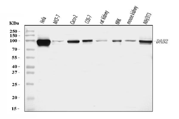 Anti-DAB2 Antibody