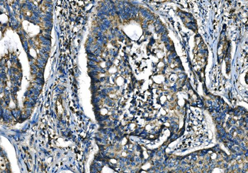 Anti-CX3CR1 Antibody