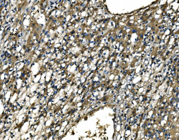 Anti-CX3CR1 Antibody