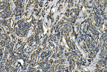 Anti-CX3CR1 Antibody