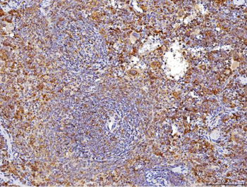 Anti-Cd70 Antibody