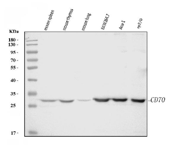Anti-Cd70 Antibody