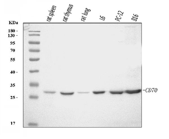 Anti-Cd70 Antibody