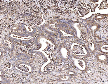 Anti-CBL Antibody