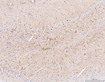 Anti-Aquaporin 4/AQP4 Antibody
