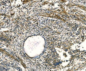 Anti-Apelin/APLN Antibody