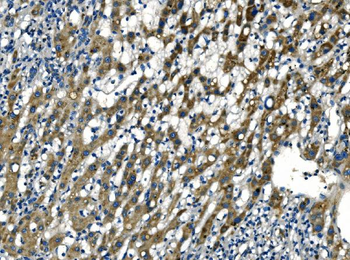 Anti-Apelin/APLN Antibody