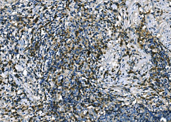 Anti-Apelin/APLN Antibody