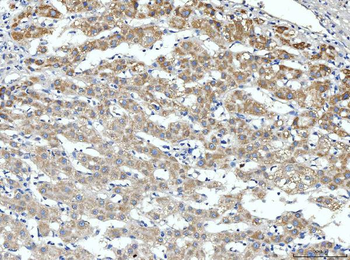 Anti-ALDH3A1 Antibody
