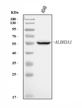 Anti-ALDH3A1 Antibody