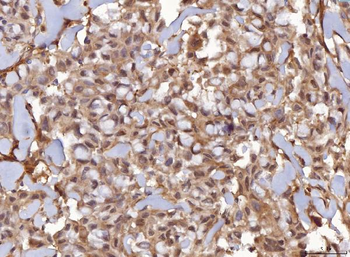 Anti-AHA1/AHSA1 Antibody