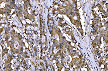 Anti-AHA1/AHSA1 Antibody