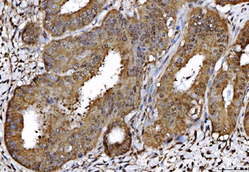 Anti-AHA1/AHSA1 Antibody