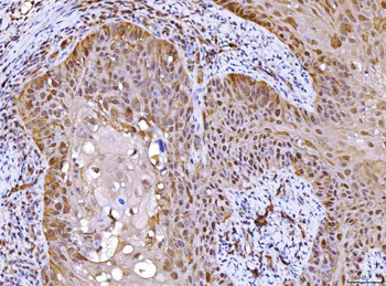 Anti-AHA1/AHSA1 Antibody