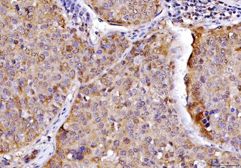 Anti-AHA1/AHSA1 Antibody