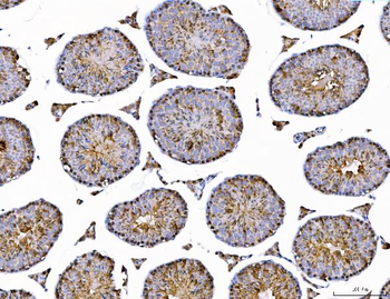 Anti-AHA1/AHSA1 Antibody