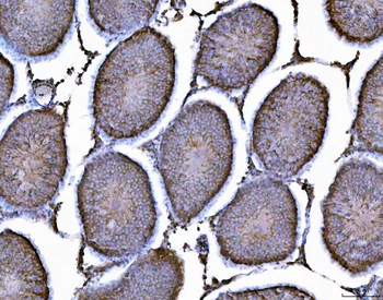 Anti-AHA1/AHSA1 Antibody