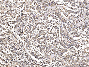Anti-Angiotensinogen/AGT Antibody