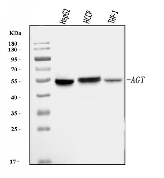 Anti-Angiotensinogen/AGT Antibody