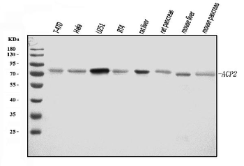 ACP2 Antibody