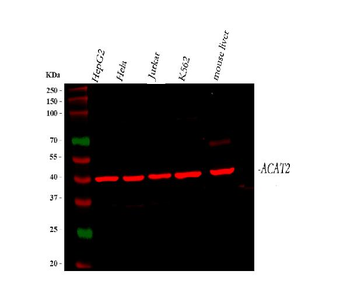 Anti-ACAT2 Antibody