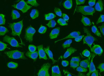 Anti-ACADM/MCAD Antibody