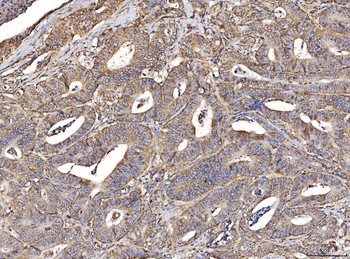 Anti-ACADM/MCAD Antibody