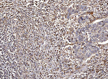Anti-ACADM/MCAD Antibody