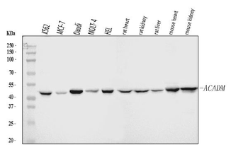 Anti-ACADM/MCAD Antibody