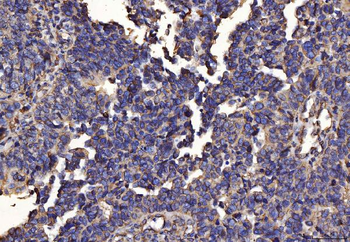 Anti-PDIA6 Antibody (monoclonal, 3H5E7)