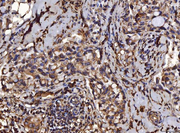Anti-PDIA6 Antibody (monoclonal, 3H5E7)