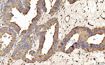 Anti-PDIA6 Antibody (monoclonal, 3H5E7)