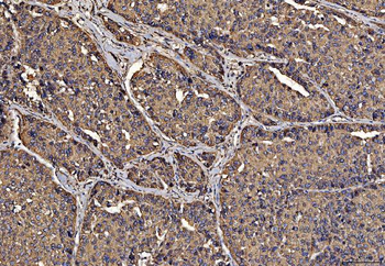Anti-PDIA6 Antibody (monoclonal, 3H5E7)