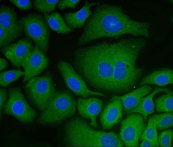 PDIA6 Antibody (monoclonal, 3H5E7)